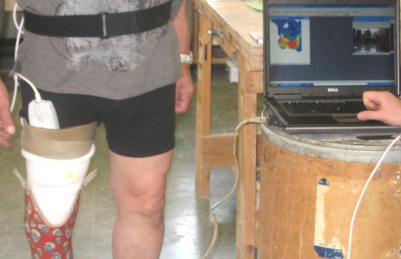 F-Socket system in action