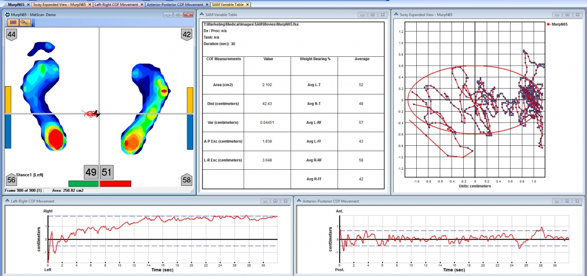 SAM provides insights into sway area and COF movement.